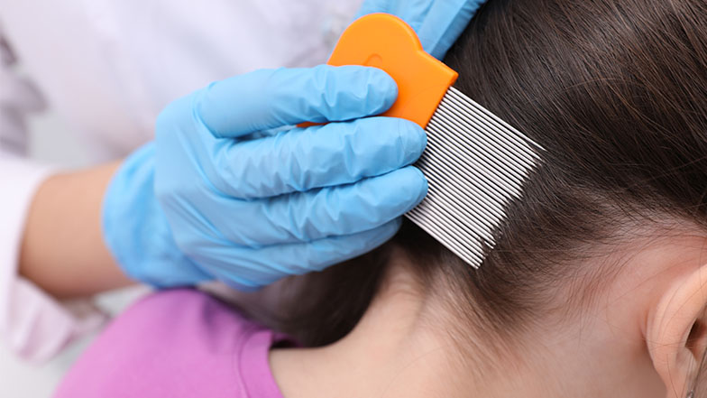 La prevención para no contraer piojos es fundamental. (Foto: Shutterstock) La prevención para no contraer piojos es fundamental. (Foto: Shutterstock)