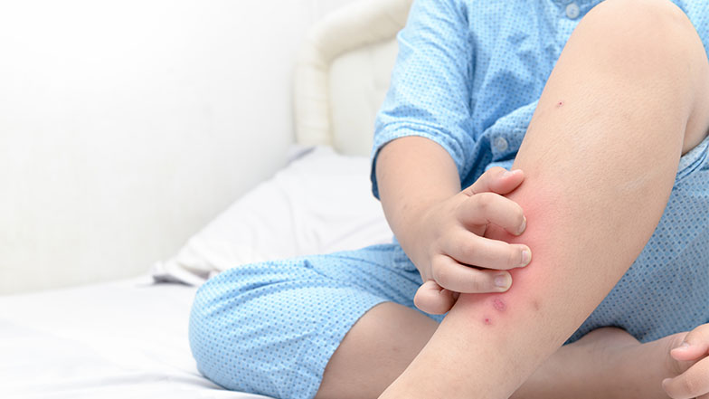Evitar su entrada es la mejor forma de prevenirlas. (Foto: Shutterstock) Evitar su entrada es la mejor forma de prevenirlas. (Foto: Shutterstock)