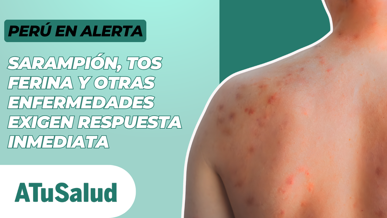 Enfermedades que regresan: las alertas sanitarias que el Perú no puede ignorar